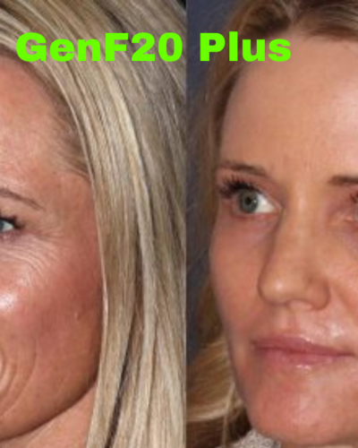 The Best Anti Aging Supplement #Look Younger