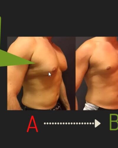 The Best Chest Fat Burning Supplement for Men Breast Reduction