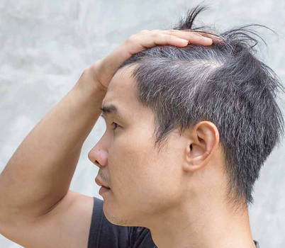 Grey Hair Treatment for Men 