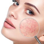 Skinception Rosacea Relief Serum Reviews